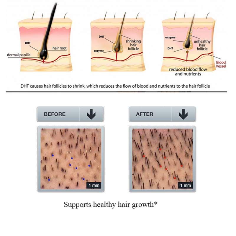 PURC Ginger Hair Loss Shampoo  - đánh giá và giá Licorice Root Sticks